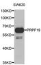 Pre-mRNA-processing factor 19 antibody, STJ28789, St John