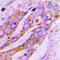ATP Synthase Membrane Subunit F antibody, GTX56084, GeneTex, Immunohistochemistry paraffin image 