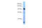 Poly(ADP-ribose) glycohydrolase antibody, ARP63555_P050, Aviva Systems Biology, Western Blot image 