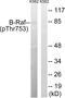 B-Raf Proto-Oncogene, Serine/Threonine Kinase antibody, AP55804PU-N, Origene, Western Blot image 