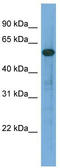 Rho GTPase Activating Protein 15 antibody, TA344856, Origene, Western Blot image 