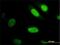 YAP1 antibody, H00010413-M01, Novus Biologicals, Immunofluorescence image 