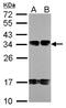 N(Alpha)-Acetyltransferase 80, NatH Catalytic Subunit antibody, LS-C185638, Lifespan Biosciences, Western Blot image 