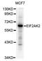 Interferon-induced, double-stranded RNA-activated protein kinase antibody, TA332778, Origene, Western Blot image 