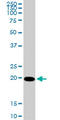 Cytidine/Uridine Monophosphate Kinase 1 antibody, LS-B5994, Lifespan Biosciences, Western Blot image 