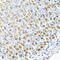 Ferrochelatase, mitochondrial antibody, 23-569, ProSci, Immunohistochemistry frozen image 