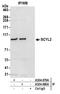 SCY1 Like Pseudokinase 2 antibody, A304-880A, Bethyl Labs, Immunoprecipitation image 