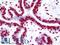 Nuclear mitotic apparatus protein 1 antibody, LS-B11047, Lifespan Biosciences, Immunohistochemistry paraffin image 