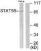 Signal Transducer And Activator Of Transcription 5B antibody, TA314575, Origene, Western Blot image 