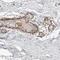 Cerebellar Degeneration Related Protein 2 antibody, PA5-54903, Invitrogen Antibodies, Immunohistochemistry frozen image 