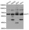 Histone acetyltransferase MYST2 antibody, TA332940, Origene, Western Blot image 