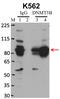 DNA Methyltransferase 3 Beta antibody, 49-1028, Invitrogen Antibodies, Immunoprecipitation image 