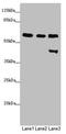 Pre-MRNA Processing Factor 4 antibody, LS-C676311, Lifespan Biosciences, Western Blot image 