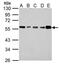Inositol Hexakisphosphate Kinase 1 antibody, MA5-17268, Invitrogen Antibodies, Western Blot image 