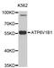 ATPase H+ Transporting V1 Subunit B1 antibody, STJ111197, St John