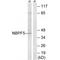 Neuroblastoma breakpoint family member 5 antibody, A18479, Boster Biological Technology, Western Blot image 