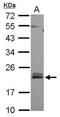 Rho-related GTP-binding protein RhoB antibody, PA5-77865, Invitrogen Antibodies, Western Blot image 