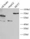 Activin A Receptor Type 1B antibody, FNab00129, FineTest, Western Blot image 