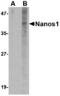 Nanos C2HC-Type Zinc Finger 1 antibody, MBS151552, MyBioSource, Western Blot image 