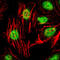 Zinc Finger And BTB Domain Containing 16 antibody, M00817, Boster Biological Technology, Immunofluorescence image 