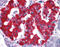 V-set domain-containing T-cell activation inhibitor 1 antibody, 51-351, ProSci, Immunohistochemistry paraffin image 