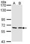 UDP-glucuronosyltransferase 1-F antibody, LS-C109532, Lifespan Biosciences, Western Blot image 