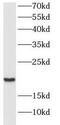 CGRP Receptor Component antibody, FNab01955, FineTest, Western Blot image 