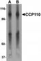 Centrosomal protein CP110 antibody, TA319786, Origene, Western Blot image 