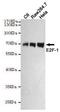 E2F-1 antibody, GTX66839, GeneTex, Western Blot image 