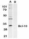 BCL10 Immune Signaling Adaptor antibody, TA306011, Origene, Western Blot image 
