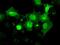 Nuclear Receptor Binding Protein 1 antibody, GTX84007, GeneTex, Immunofluorescence image 