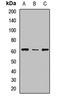 UDP Glucuronosyltransferase Family 2 Member B10 antibody, LS-C668083, Lifespan Biosciences, Western Blot image 