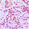 SUMO Peptidase Family Member, NEDD8 Specific antibody, LS-C353623, Lifespan Biosciences, Immunohistochemistry paraffin image 