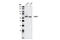 Forkhead Box O4 antibody, 9472S, Cell Signaling Technology, Western Blot image 