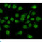 CTF antibody, LS-C813058, Lifespan Biosciences, Immunocytochemistry image 