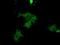 Protein Kinase CGMP-Dependent 1 antibody, NBP2-02521, Novus Biologicals, Immunofluorescence image 