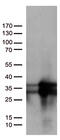 O-6-Methylguanine-DNA Methyltransferase antibody, CF809255, Origene, Western Blot image 