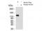BTB Domain And CNC Homolog 2 antibody, TA319354, Origene, Western Blot image 