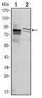 Kelch Like Family Member 11 antibody, AM06476SU-N, Origene, Western Blot image 