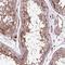 Spermatogenesis Associated Serine Rich 2 antibody, HPA038643, Atlas Antibodies, Immunohistochemistry frozen image 