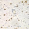 Cell Division Cycle 25A antibody, LS-C331324, Lifespan Biosciences, Immunohistochemistry paraffin image 