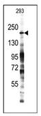 KDM6B antibody, AP11034PU-N, Origene, Western Blot image 