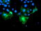 Peroxisomal Trans-2-Enoyl-CoA Reductase antibody, LS-C785137, Lifespan Biosciences, Immunofluorescence image 