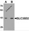 Solute Carrier Family 35 Member D2 antibody, 6545, ProSci Inc, Western Blot image 