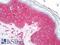 MC1 antibody, LS-C229988, Lifespan Biosciences, Immunohistochemistry frozen image 