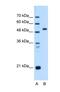 Suppression Of Tumorigenicity 14 antibody, NBP1-56649, Novus Biologicals, Western Blot image 
