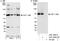 Chromatin Assembly Factor 1 Subunit B antibody, A301-085A, Bethyl Labs, Western Blot image 