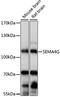 Semaphorin 4G antibody, 16-071, ProSci, Western Blot image 