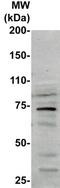 Heat Shock Transcription Factor 1 antibody, TA354393, Origene, Western Blot image 