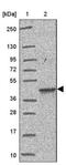 One Cut Homeobox 2 antibody, NBP2-31658, Novus Biologicals, Western Blot image 